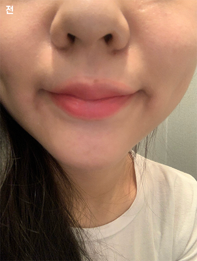 [쁘띠] リリルル - 唇