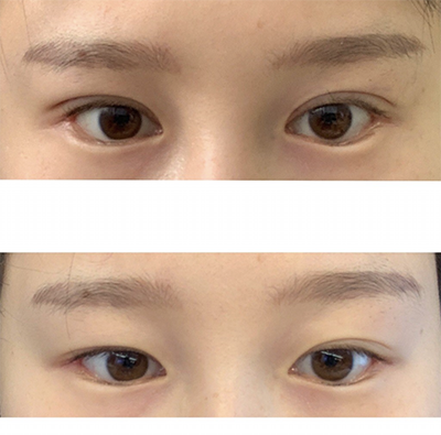 [눈] 참치마요잉 - 눈