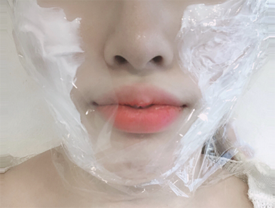 [피부] ㅁㅋㅌㅇㅎㅅ - 슈링크, 윤곽톡스