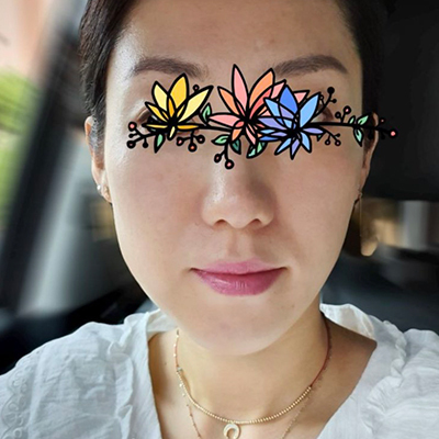 [코] 총총총순이 - 코조각주사, 콧볼보톡스