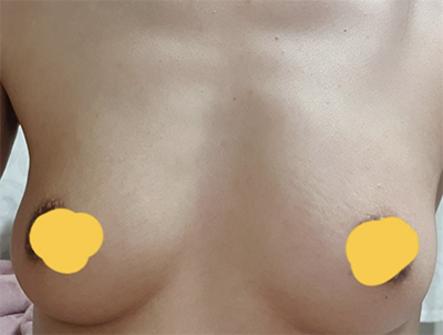 [가슴] 희잇 - 가슴