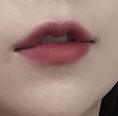 [쁘띠] amy13 - 입술필러