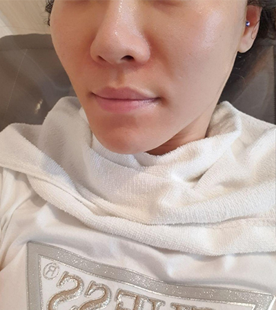 [Da] Bong Berry - Air Shrink