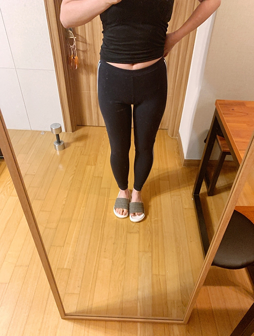 [Hút mỡ] asura87 - Hút mỡ toàn thân