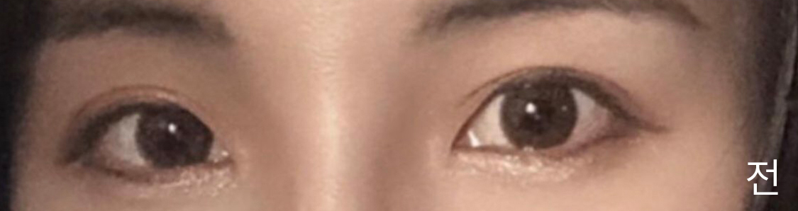 [Mắt] Trinity91 - Mắt