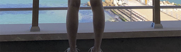 [Tiểu phẫu] anyy - Bắp chân