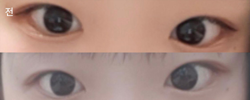 [Mắt] Shin Eun-seo đây ạ - Mắt