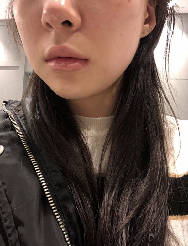 [Da] Hanahaneung - Nâng cơ bằng máy Shrink