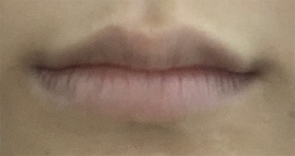 [Tiểu phẫu] Chiquins - Môi