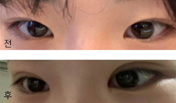 [Mắt] Choki1234 - Mắt