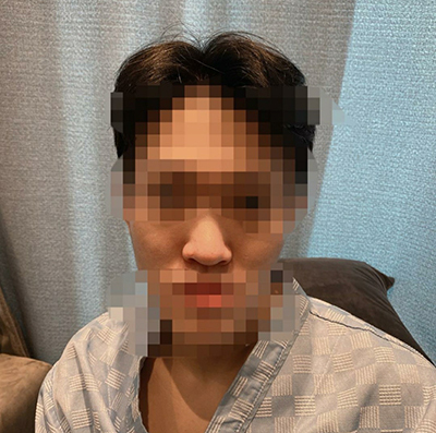 [코] 지렁이2@ - 코