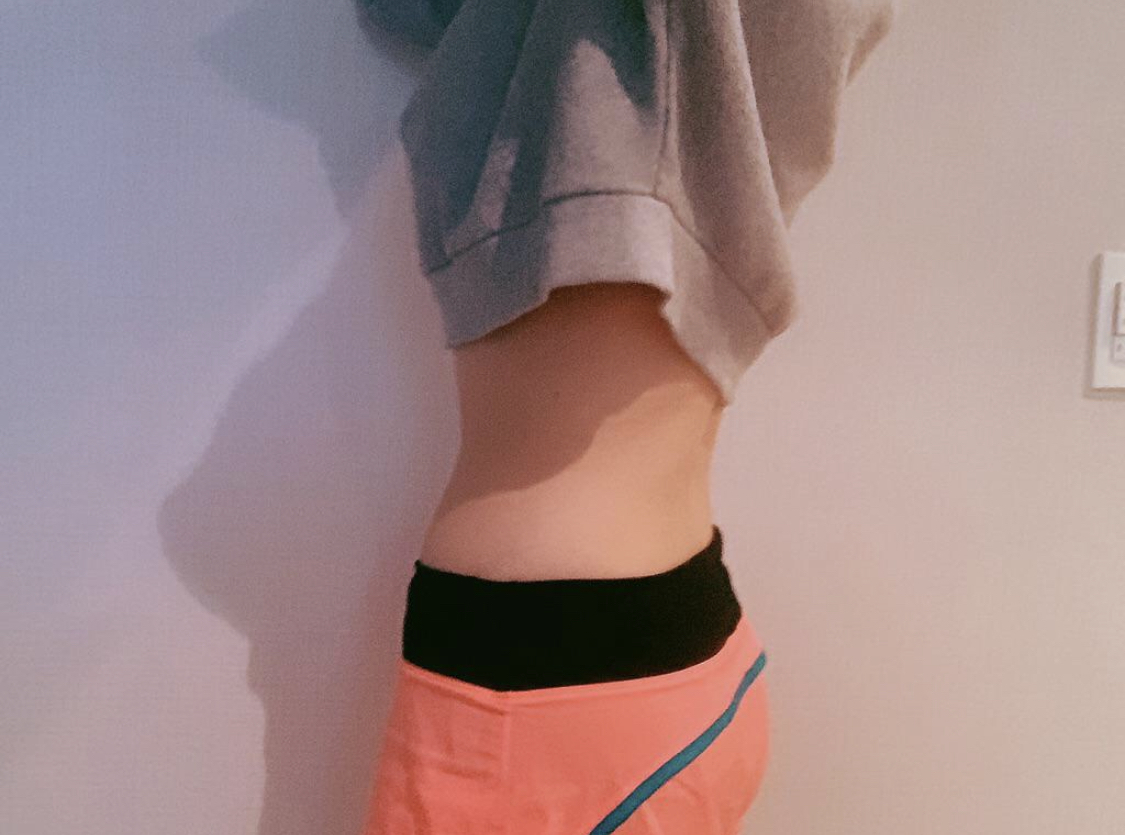 [Hút mỡ] yedu87 - Hút mỡ chân, bụng