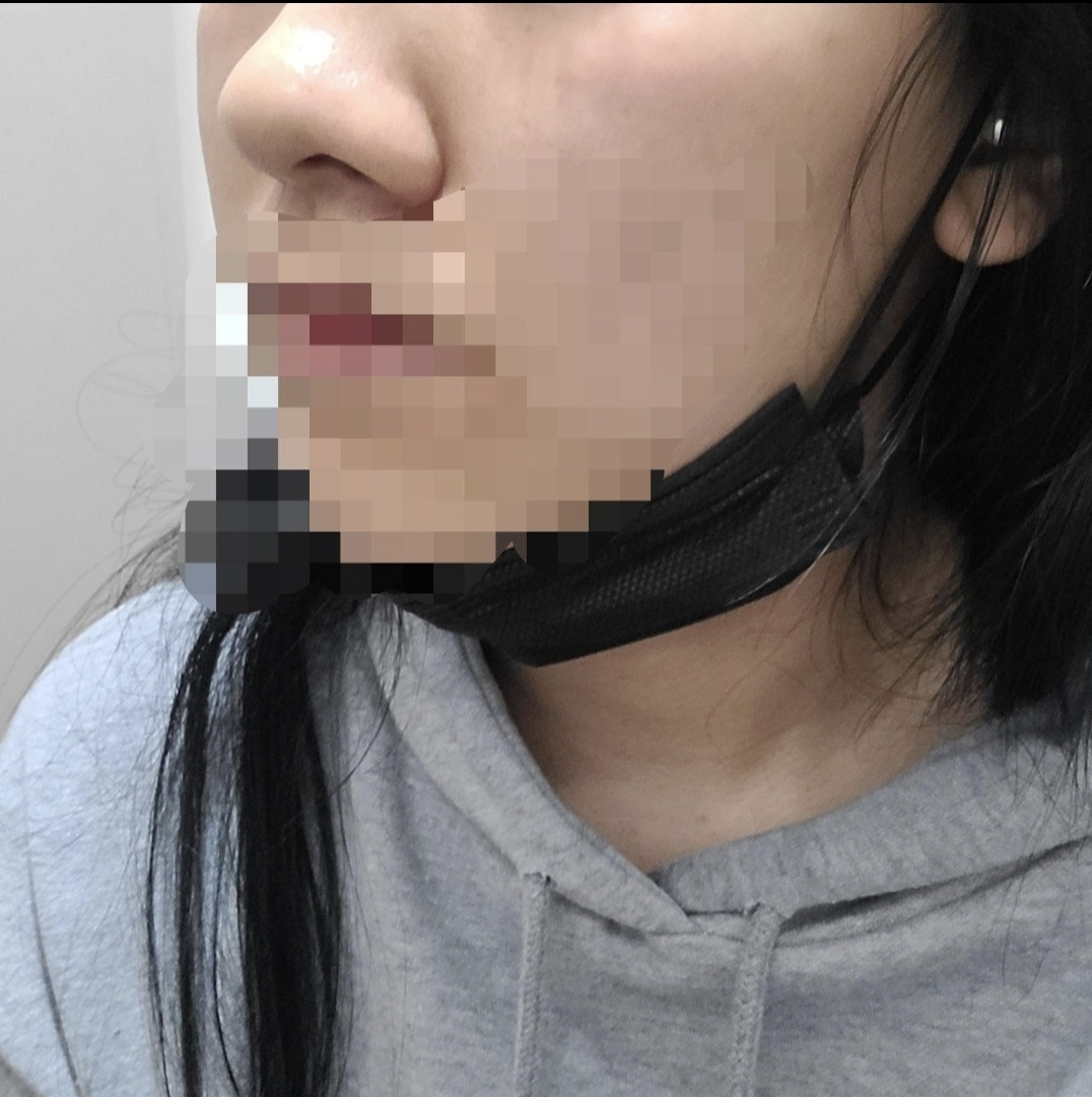 [Mũi] Chuẩn bị - Mũi