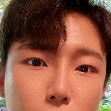 [Nam] Aiden - Bấm mí, Tái định vị mỡ dưới mắt, Mũi