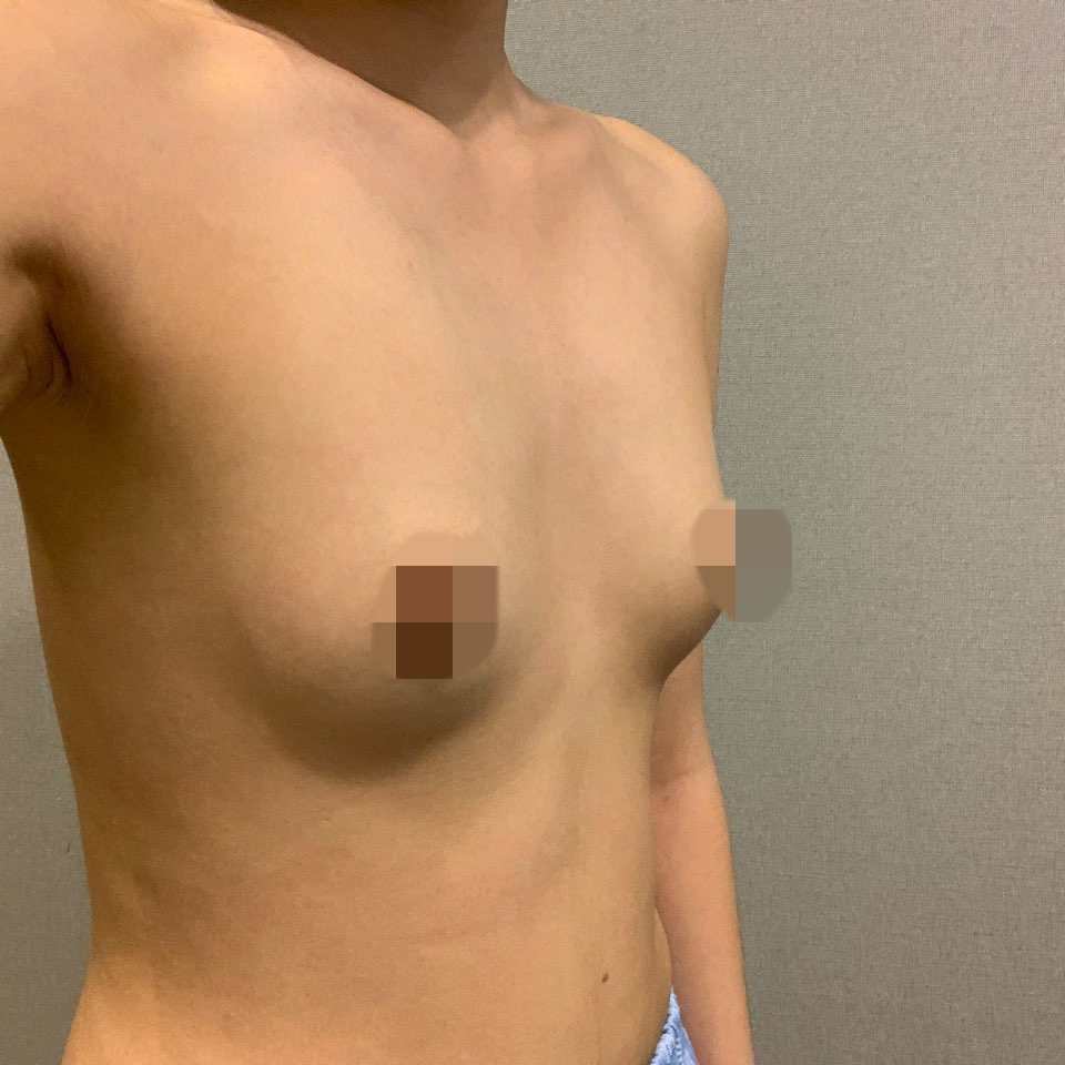 [Ngực] Yang Yang Yang - Ngực