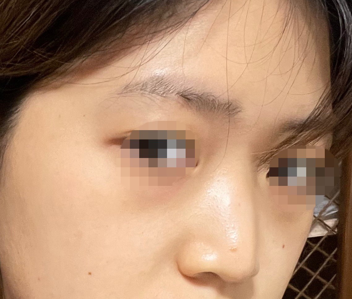 [Mắt] Sunde Della - Mắt, Mũi