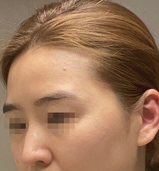 [Mũi] Gác xép mèo - Mũi