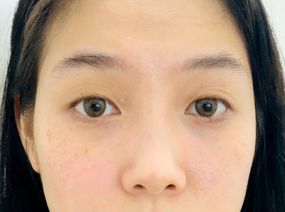 [Mắt] Beth Girl - Mắt, Mũi