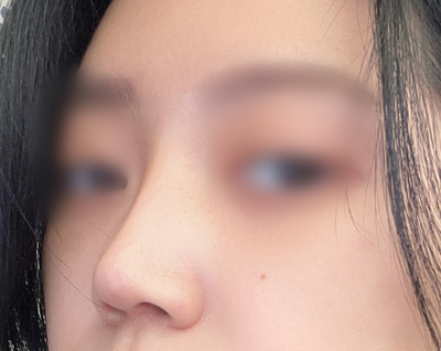 [Mũi] Thay Đổi Ngoạn Mục - Mũi