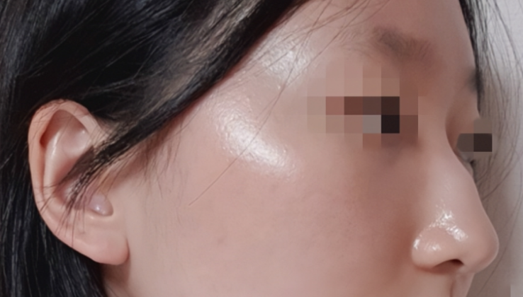 [Mũi] Pinocchio - Mũi