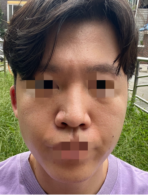 [Хамрын] Мэбул - Хамар