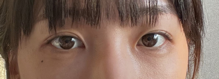 [Mắt] Ruby Lung - Mắt