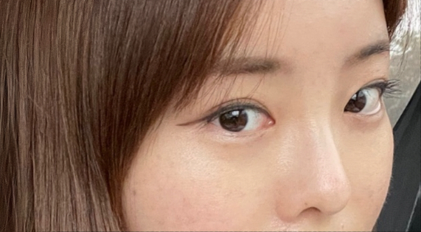 [Mũi] Miyoomyu - Mũi