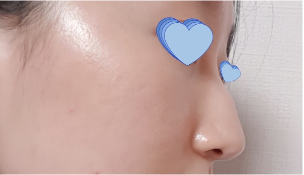 [Хамрын] Муухай шулам - Хамар