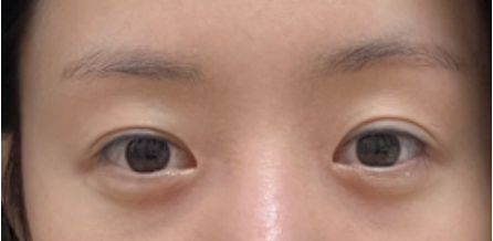 [Mắt] Ba vạn dặm - Mắt