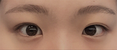 [눈] 밍루루루룩 - 눈