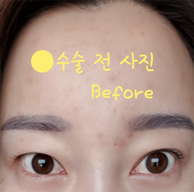 [눈] 아메숏헤어 - 눈