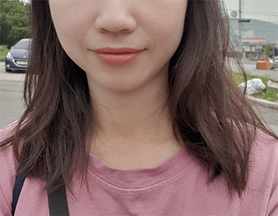 [쁘띠] 해바라기ssi - 슈링크, 윤곽톡스