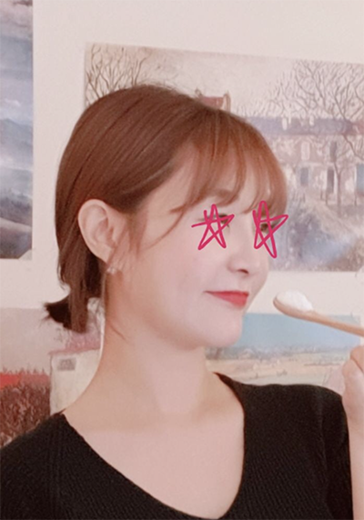 [피부] 케바케잘되길 - 슈링크