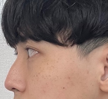 [Mũi] Hip Hinge - Mũi