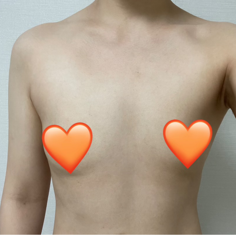 [Ngực] Centri - Ngực