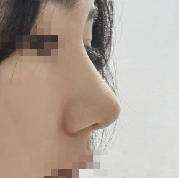 Giá mà mình làm sớm hơn thì tốt rồi ㅠㅠ